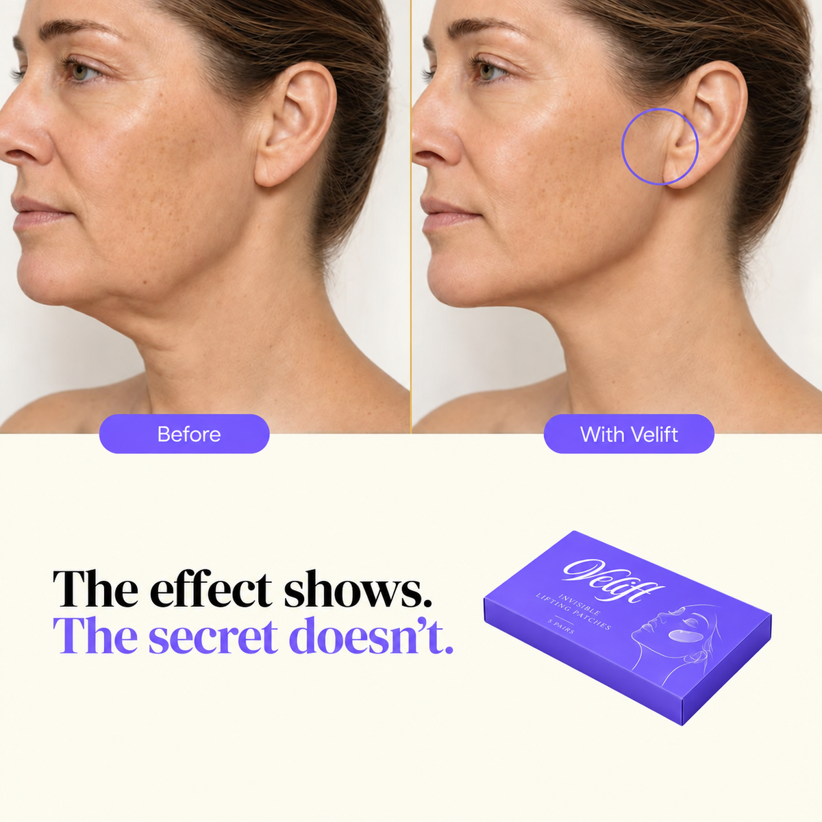 Pack Velift® - Face UP